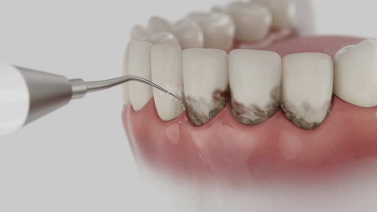 Reliable Root Canal Treatment contractor in Lyon County County, KY by Dentist Open Now